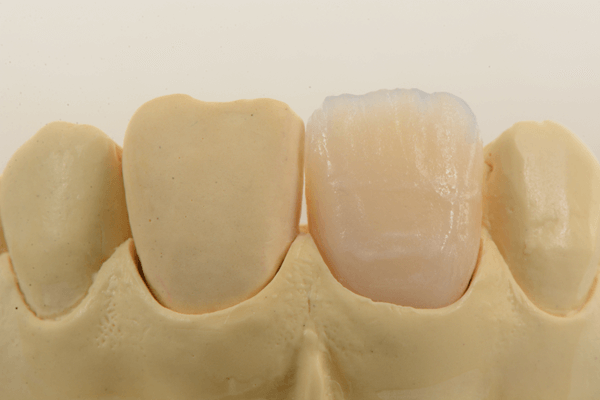Read more about the article Simplificando o controle de cores na dentina