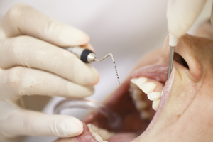 periodontite e peri-implantite