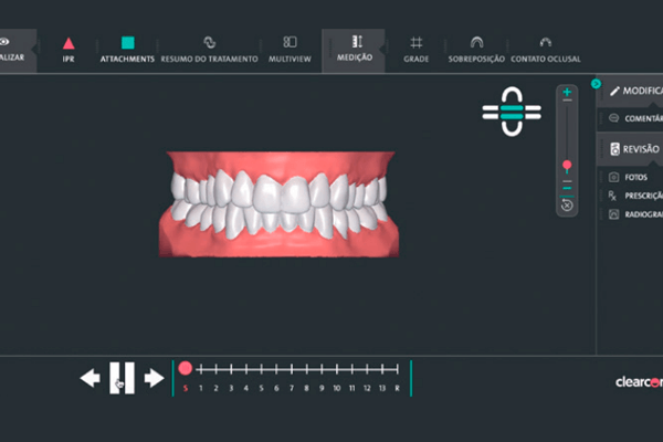 Ortodontia pode resolver DTM? - Dentista em Foz do Iguaçu - Aparelho  Ortodôntico - Facetas - Implantes - Próteses - Prime Sorriso Odontologia