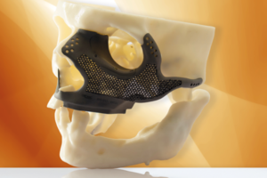 Cirurgia Bucomaxilofacial