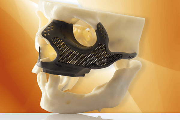 Read more about the article Uma nova era: tecnologias para Cirurgia Bucomaxilofacial