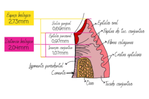 Read more about the article Entendendo o sulco gengival