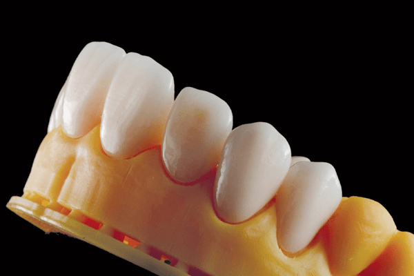 Read more about the article “Você só encontra esses problemas na Odontologia Digital?”