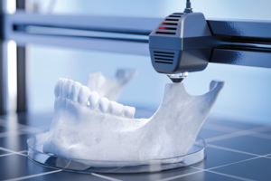 Read more about the article Resultados relatados pelos pacientes para o fluxo de trabalho digital versus analógico nas próteses fixas sobre dentes: uma revisão sistemática