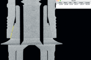 Read more about the article Análise da adaptação interna de pilares protéticos originais e multiplataformas sobre implantes