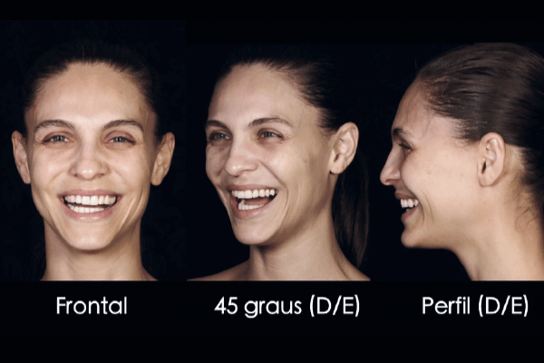 You are currently viewing A fotografia de face como ferramenta diagnóstica bidimensional