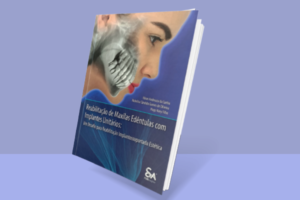 livro reabilitação implantes unitários