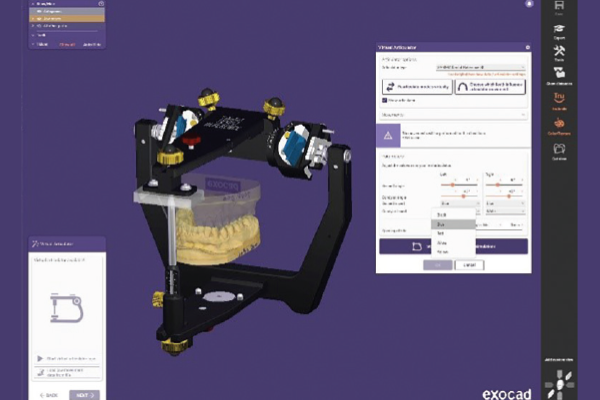 You are currently viewing DentalCAD 3.2 Elefsina: novas funcionalidades em destaque