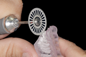 Read more about the article Placa oclusal impressa confeccionada por meio de fluxo digital