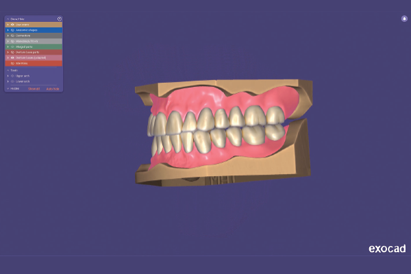 You are currently viewing Fluxo digital: exocad lança a Inspira Denture Tooth Library