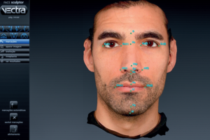 Read more about the article A estereofotogrametria da face: uma análise tridimensional padronizada
